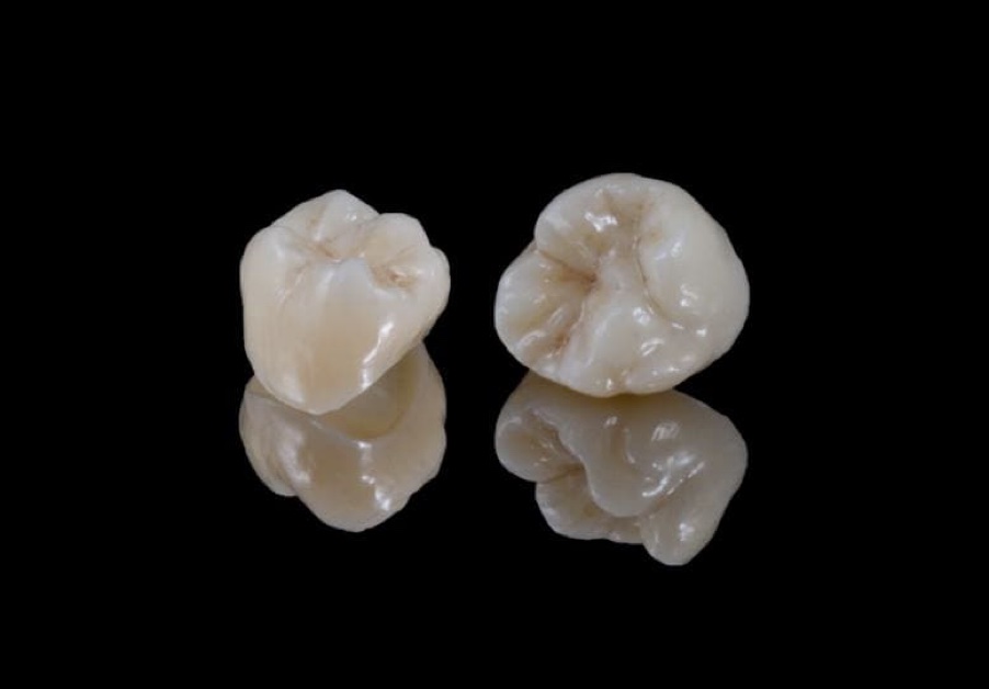 Same Day Crown